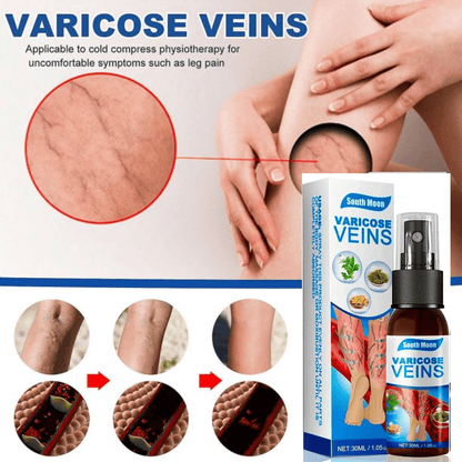 NUEVO SPRAY CURATIVO DE VENAS VARICES✔️